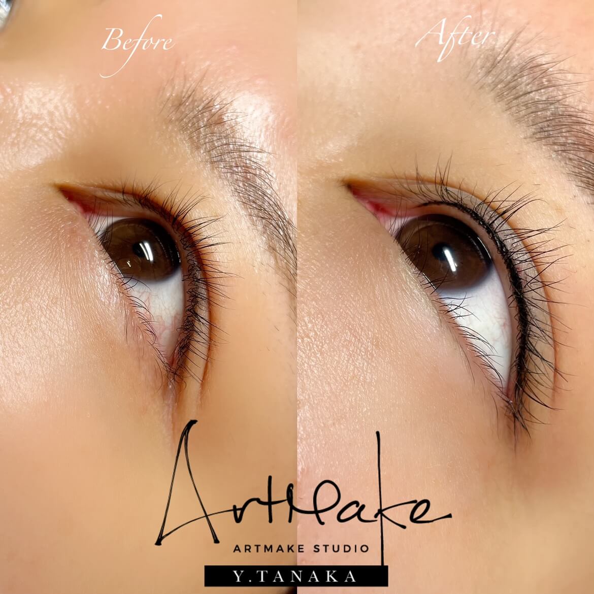 アイラインアートメイク症例画像