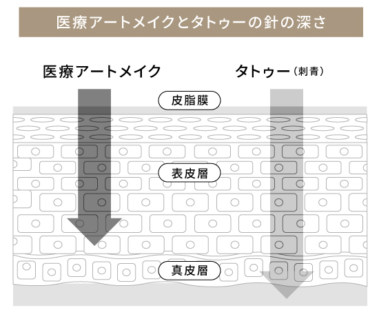 アートメイクとタトゥーの違いの図解イラスト