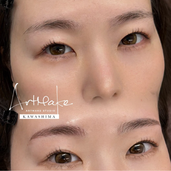 アートメイクスタジオ眉アートメイク症例画像｜毛並み｜平行ゆるアーチ