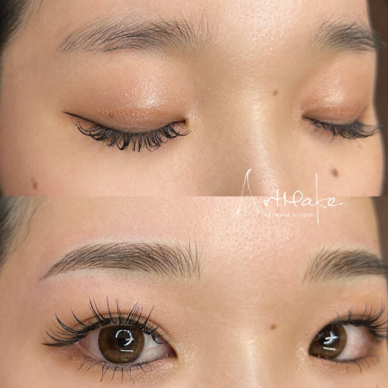 アートメイクスタジオ眉アートメイク症例画像｜MIX｜平行ゆるアーチ